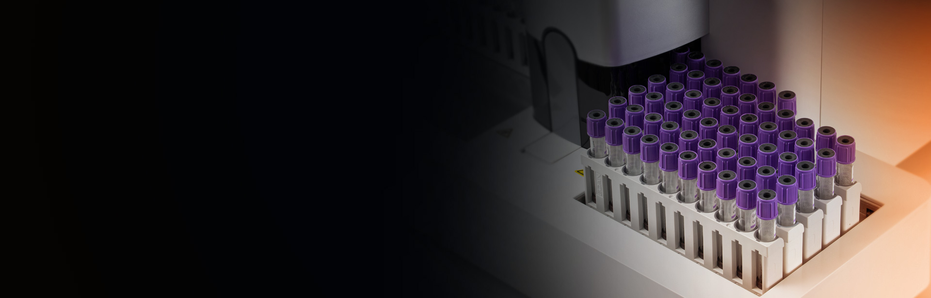Capacité 60 échantillons