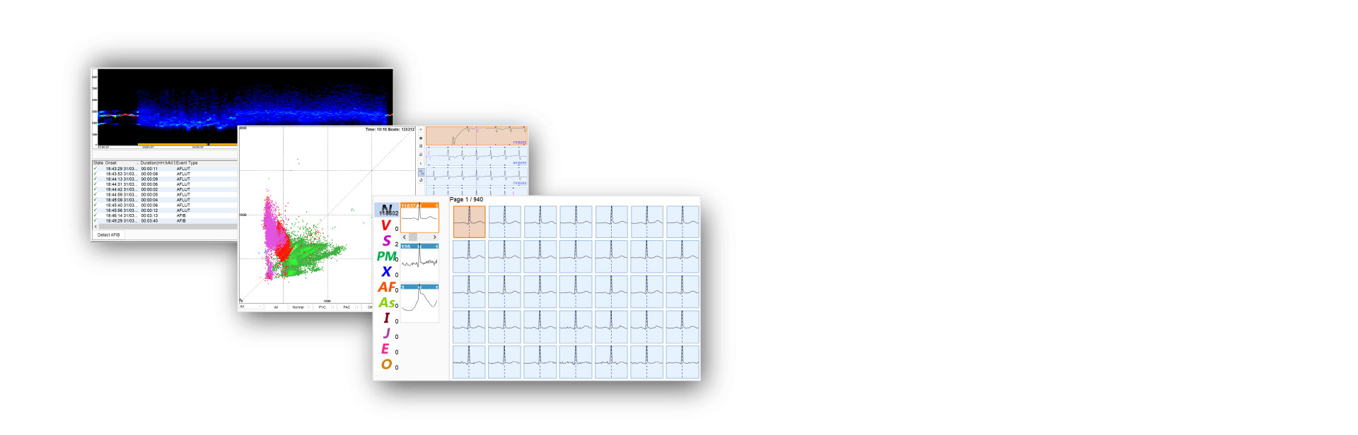 Outils d'analyse ECG