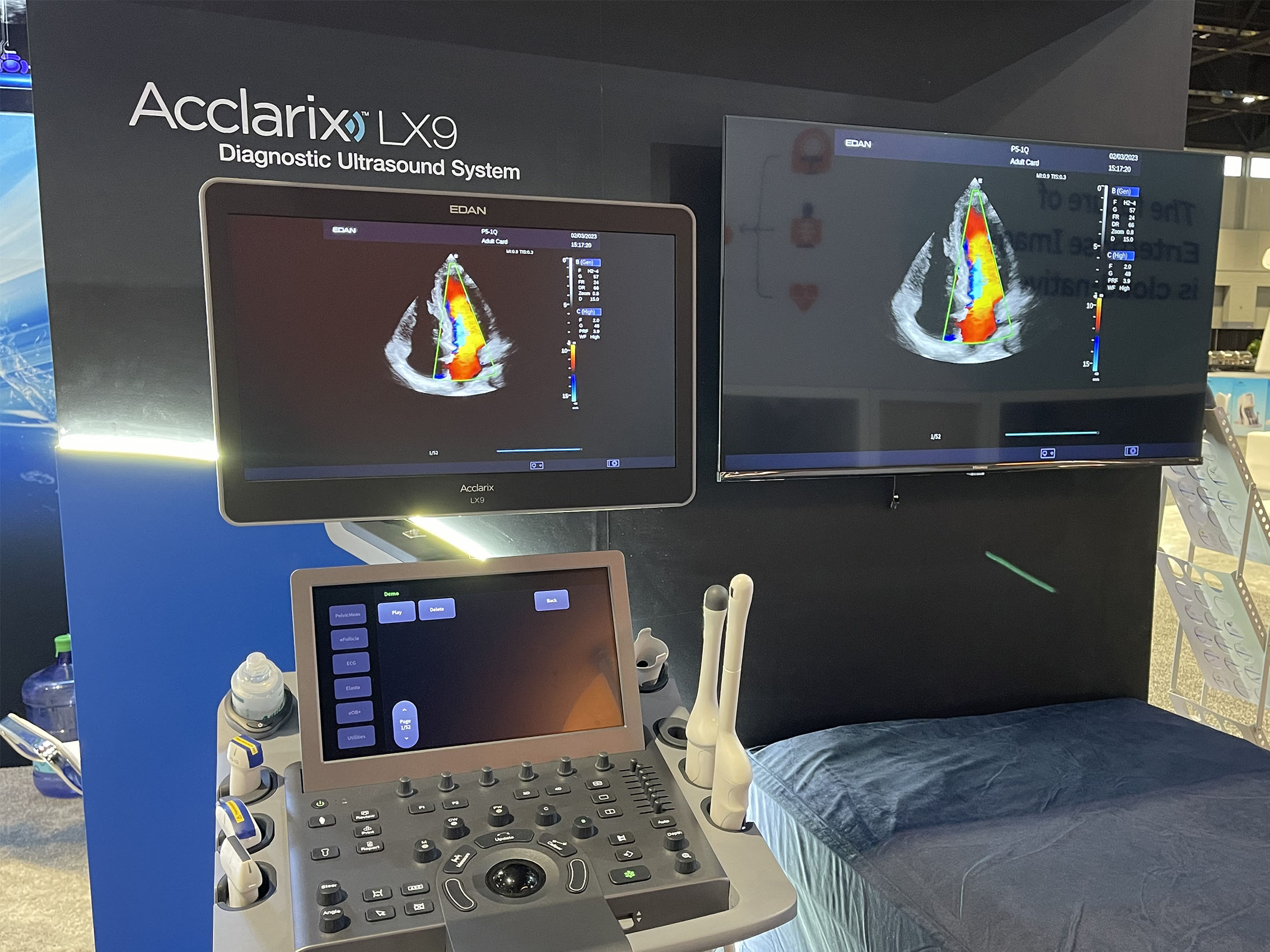 Acclarix LX9 @ RSNA 2024 copy.jpg